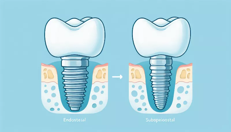 How do endosteal and subperiosteal implants differ?